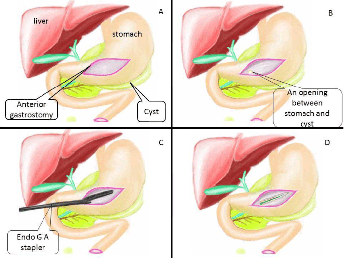 acgh-aid1015-g004