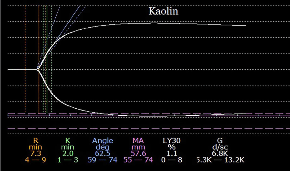 acgh-aid1032-g001