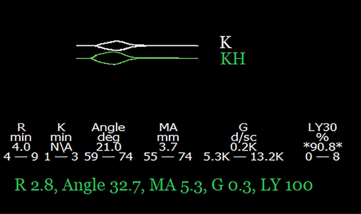 acgh-aid1032-g003