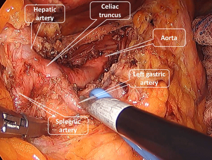 acgh-aid1034-g003